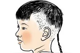 淮北部分地区风俗 “压尾辫” 据说现在又叫“讹舅辫”图片