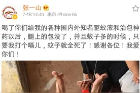 张一山，你的脚趾是在比心吗？图片