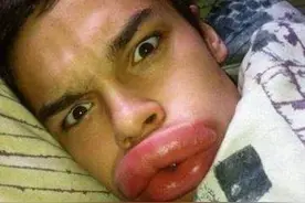 见过香肠嘴但是从来都没见过这么性感的图片