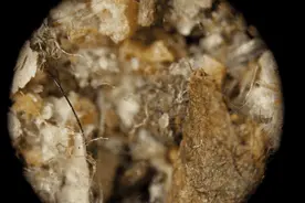 今日问答 | 螨虫无所不在怎么办？图片