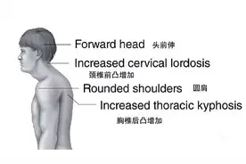 四步教你挺胸开肩!挺拔姿态!扩大胸围!图片
