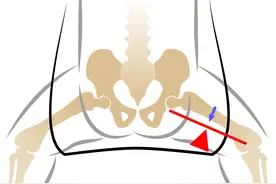 给宝宝裹襁褓的正确方式，你做对了吗？图片