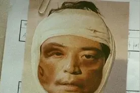 霍建华新片造型脸被打肿裹纱布 面目全非惨不忍睹图片
