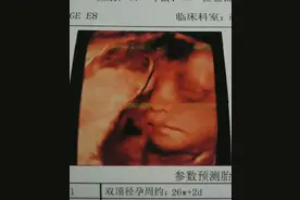 二胎四维男宝，儿女双全，附两胎的反应图片