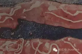 养鸡绦虫病最新权威解读？图片