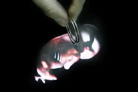 产后这样的避孕，对女人的伤害简直就是噩梦！图片