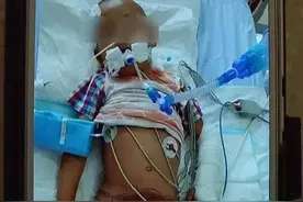 愤怒！“昆明最毒后妈”虐儿细节流出，网曝：她是虐童惯犯！图片