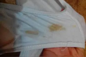 先兆流产并非真正流产，保胎要做好这几点，特定情况下切忌保胎图片