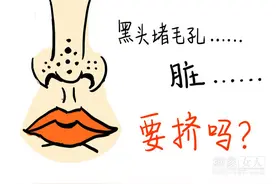 黑头不是不能挤 教你挤黑头的正确方法图片