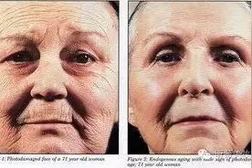 V解答丨防晒—给你的肌肤穿上金钟罩！图片