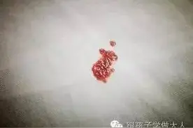 孕期准妈出现腹痛多是这几种原因，种种都很要命！图片