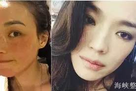 盘点“斑花”女神，揭秘张柏芝如何快速祛斑术？图片