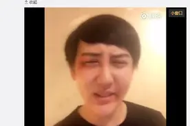 刘梓晨发微博称被打  网友：活该图片