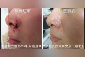 脸上有疤痕怎么办呢、、图片