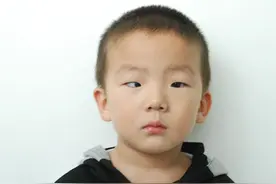 女童学唱忐忑致斜视 儿童斜视应早发现早治疗图片