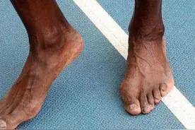 博尔特成功背后的辛酸图片