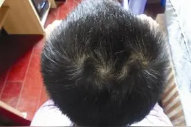 孩子头旋越多脾气越暴躁？真有这种说法吗图片