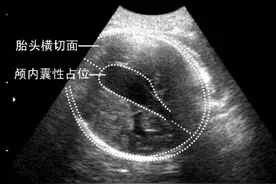 怀孕第四周胎儿发育的异常情况，这几种病毒准妈妈要避免感染图片