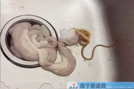 吓shi宝宝了猪小肠里居然洗出的20多厘米长的活物竟然是图片