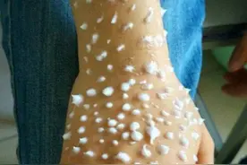 搞笑图摘第354期：涂护手霜涂成雪饼手，我的密恐症又犯了图片