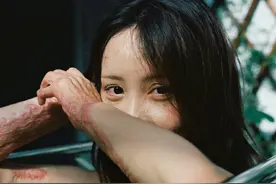 5年前“富二代”求爱不成把她严重烧伤，如今她重新站了起来图片