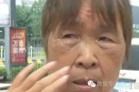 贴眼贴缓解眼疲劳 不料肿成“熊猫眼”图片