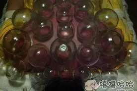 笑帝：一排大金牙，闪瞎你的眼图片