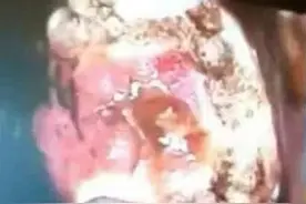 医院不愿意说出的小秘密图片