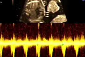 孕期21周的四维彩超，你见过胎儿胎动的样子吗视频封面