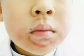 一个小动作，8岁萌娃长出胡须，颜色由红色变成深红色图片