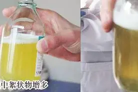血糖试条可以验尿查血糖？有上当受骗的没？图片