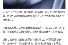 10岁男娃给尿道塞绣花针，取出已锈！医院收治多名患儿竟都是！图片
