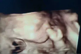 宝宝的表情动作逗乐了四维医生图片