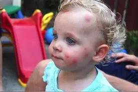 秋高气爽，正值蚊子最后的疯狂；将人蚊大战进行到底图片