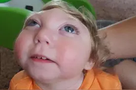 孕妈妈坚持生下无脑儿，顽强快乐的活到2岁，背后的辛酸谁知图片