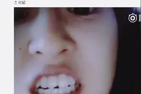 赵本山女儿假牙被磕掉 称且行且珍惜 网友:换满口假牙 值得？图片