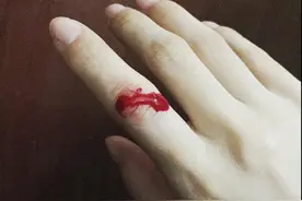 王子文手指受伤求安慰，评论区网友比惨，网友：快去找赵医生！图片