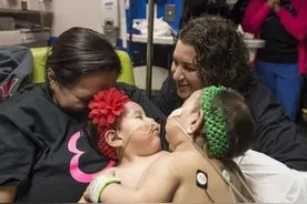 连体女婴分离手术成功后，两个小宝贝迎来新生的场景令人感动图片