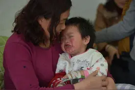 一包辣条吃得两名幼童嘴巴感染溃烂入院！别让你家孩子吃这东西！图片