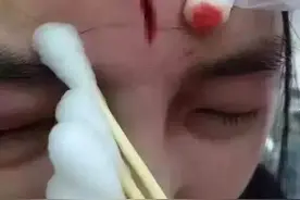 奇葩的"一针见血"规定，应立即叫停！图片