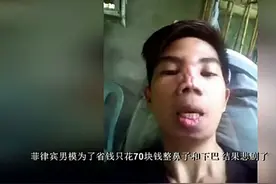 作死？为了美，菲律宾男模竟然花70块钱去整了容图片