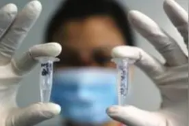 丙型肝炎病毒的检测