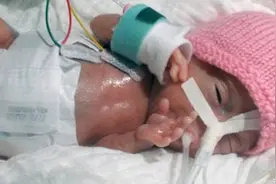 世界上最轻的宝宝，仅227克重22厘米长，护士称还没有甜椒重图片