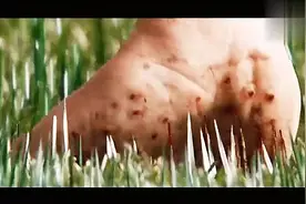 这个女人长得好奇怪，脚和手长得一模一样视频封面