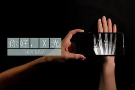 神奇！教你如何用手机拍出X光片.视频封面
