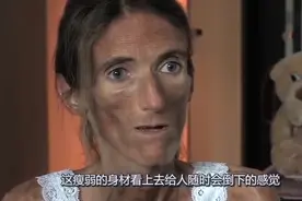 女模特疯狂减肥患厌食症，变成骨架沮丧不已，来中国后却不药而愈视频封面