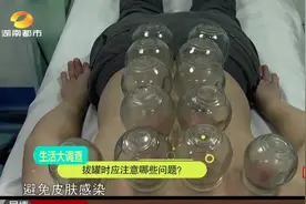 天寒拔罐排湿气，市面上拔罐器种类繁多，哪种效果会最好？视频封面