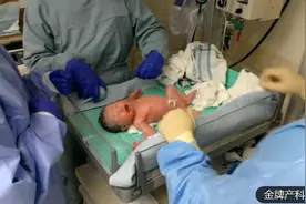 孕34周早产了，幸运的是宝宝很健康，竟有5斤多。