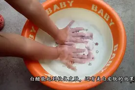 3个方法，轻松让手部变得特别的白皙，简单又厉害