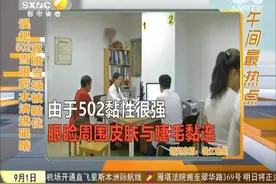 误把502当眼药水滴进眼睛 双眼当场被黏住视频封面